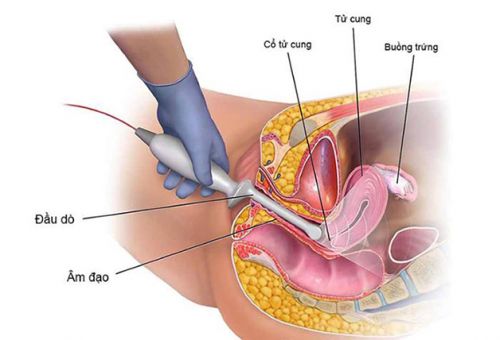 Siêu âm tử cung: Tầm quan trọng và quy trình thực hiện