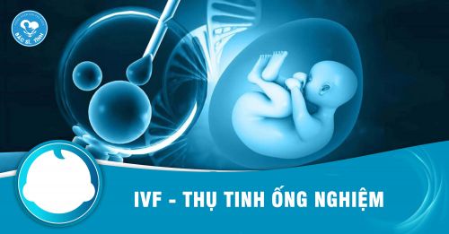 IVF là gì? Chi phí thực hiện IVF hiện nay bao nhiêu?