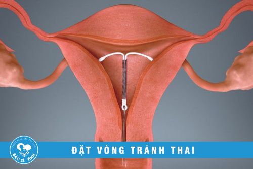 Dịch vụ đặt vòng tránh thai tại Biên Hòa