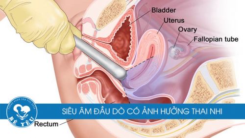 Siêu âm đầu dò khi mang thai có sao không ?