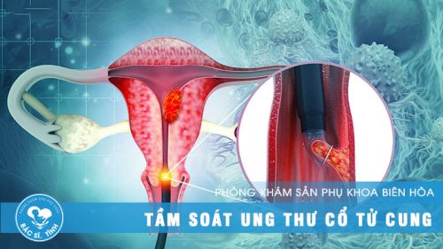 Tầm soát ung thư cổ tử cung ở Biên Hòa