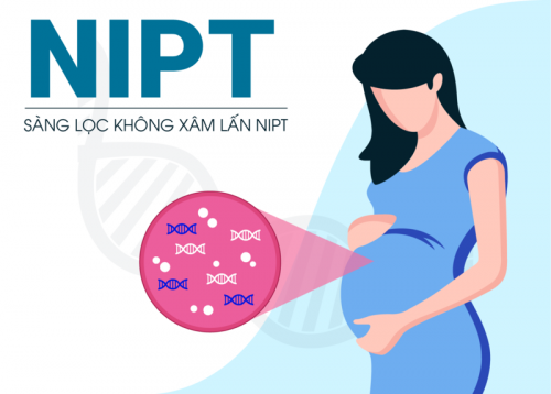 Xét nghiệm NIPT dị tật thai nhi tại Biên Hòa