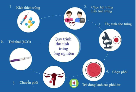 các bước IVF