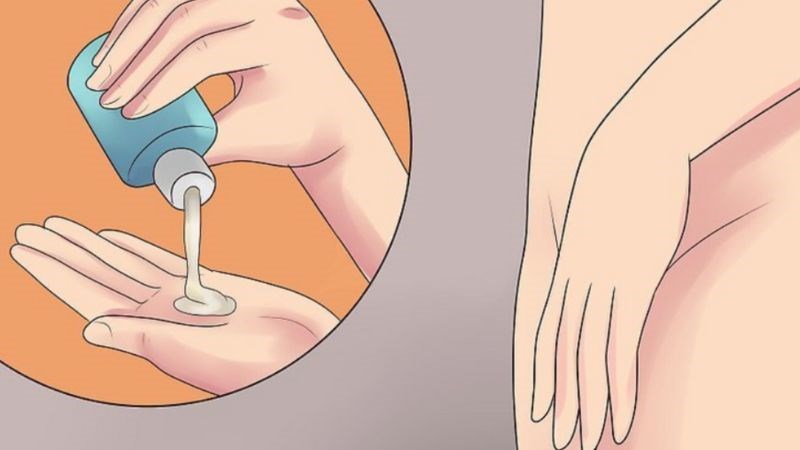 Phòng ngừa nhiễm nấm âm đạo