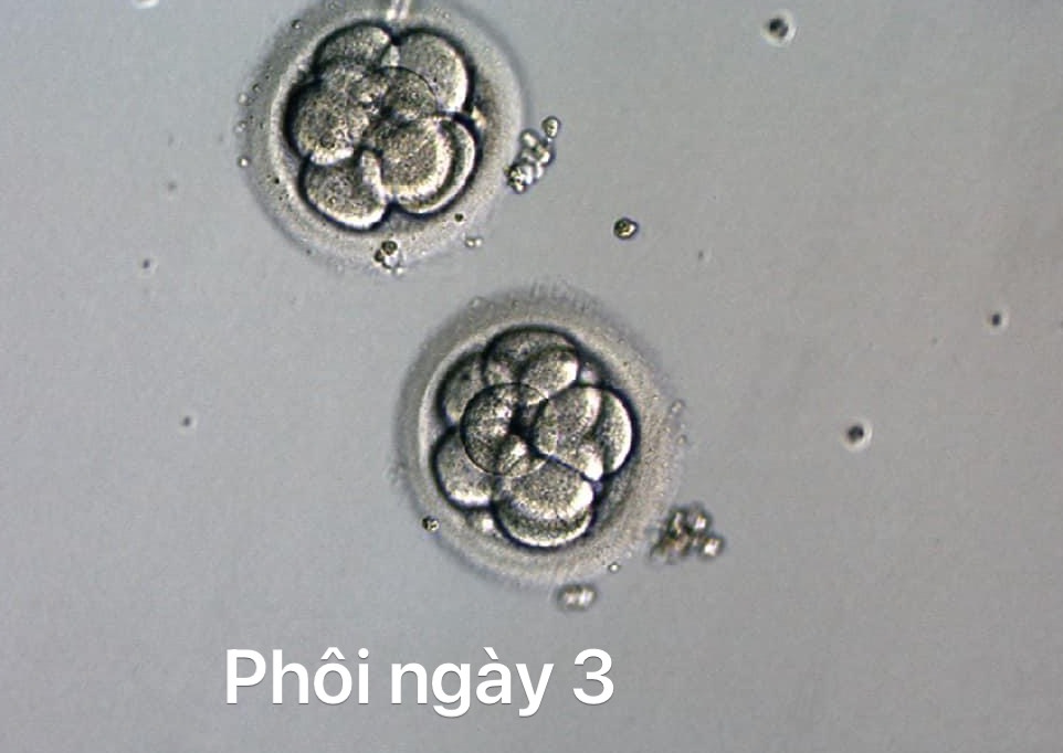 phôi chia ngày 3