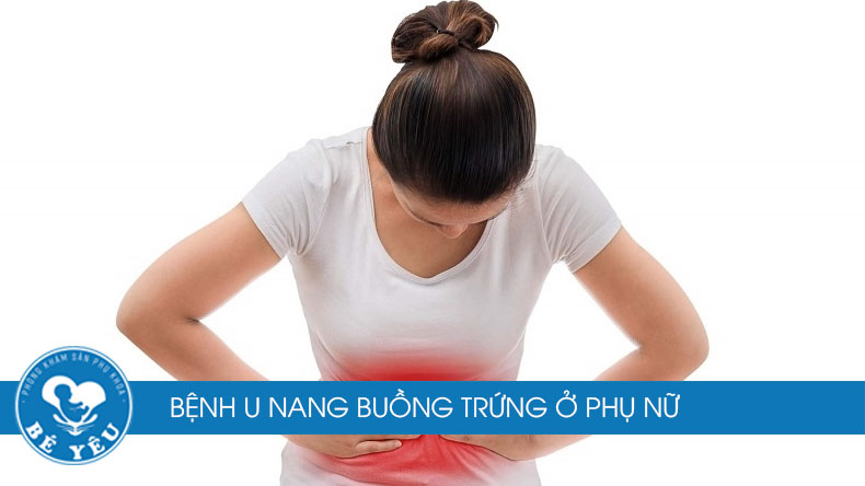 dấu hiệu u nang buồng trứng