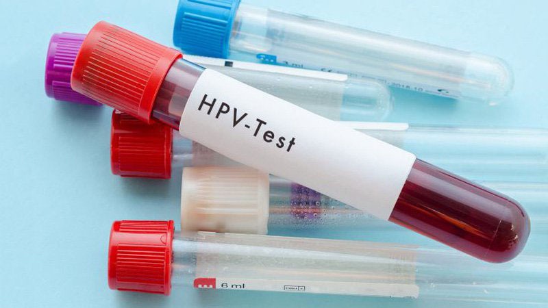 Xét nghiệm test HPV